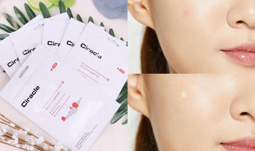 Miếng dán mụn có thiết kế hiện đại, tinh tế che đi khuyết điểm một cách tự nhiên