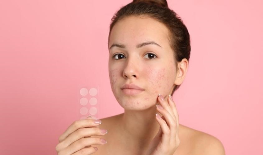 Thông thường các sản phẩm sẽ chứa thành phần kháng viêm, trị mụn