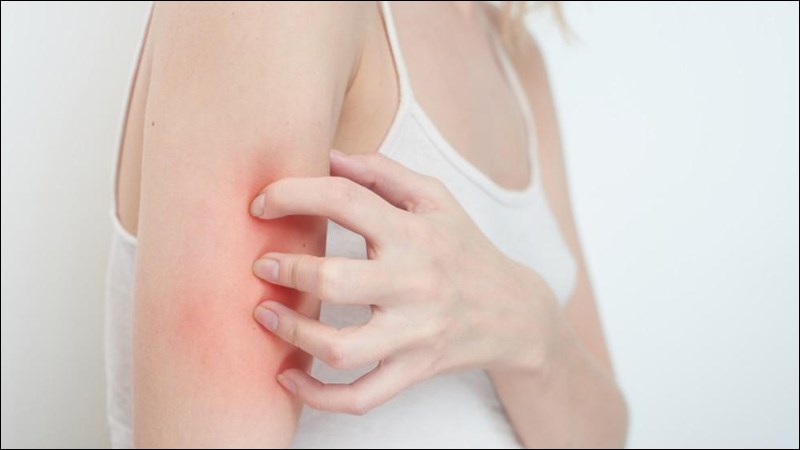 Da khô và ngứa là một trong những dấu hiệu nên lưu ý