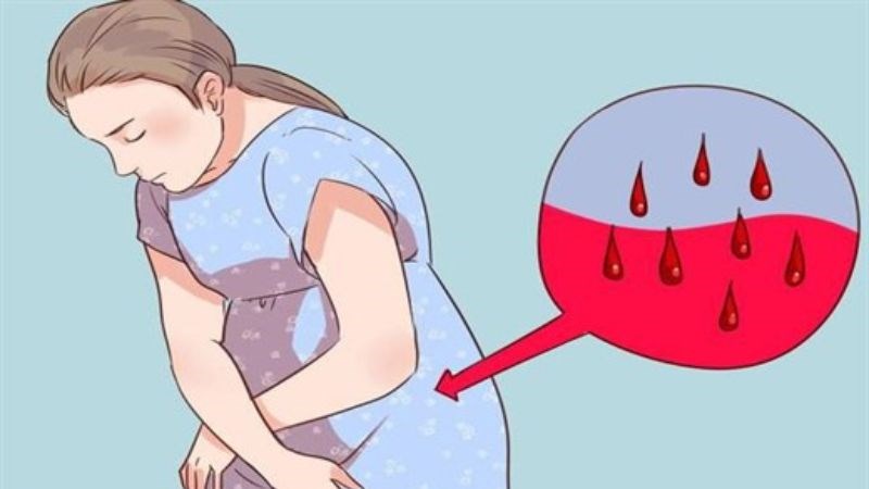 Cỏ mực chữa rong kinh ở phụ nữ 