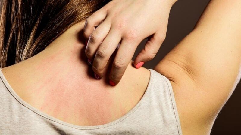 Giảm tình trạng dị ứng