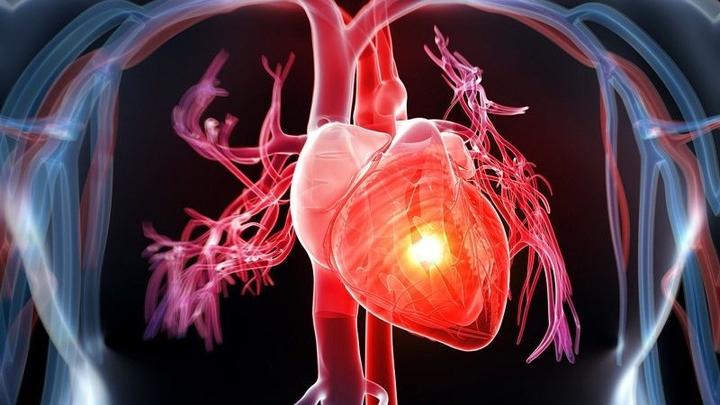 Người mắc các bệnh tim mạch không nên ăn cay