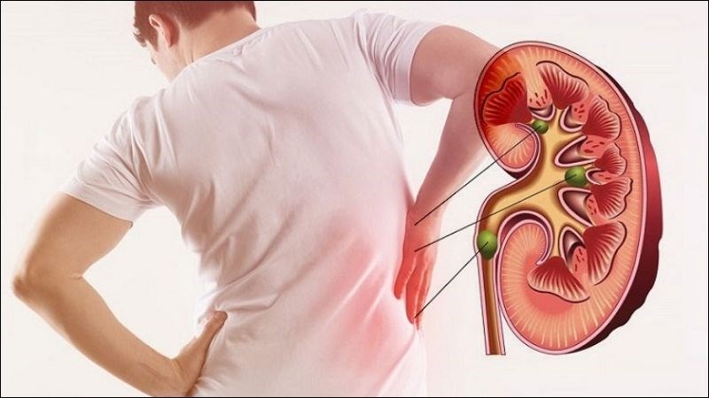 Người mắc bệnh thận không nên ăn ớt 