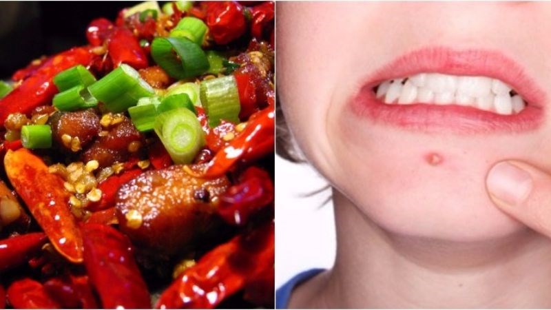 Ăn ớt dễ mọc mụn và bị kích ứng 