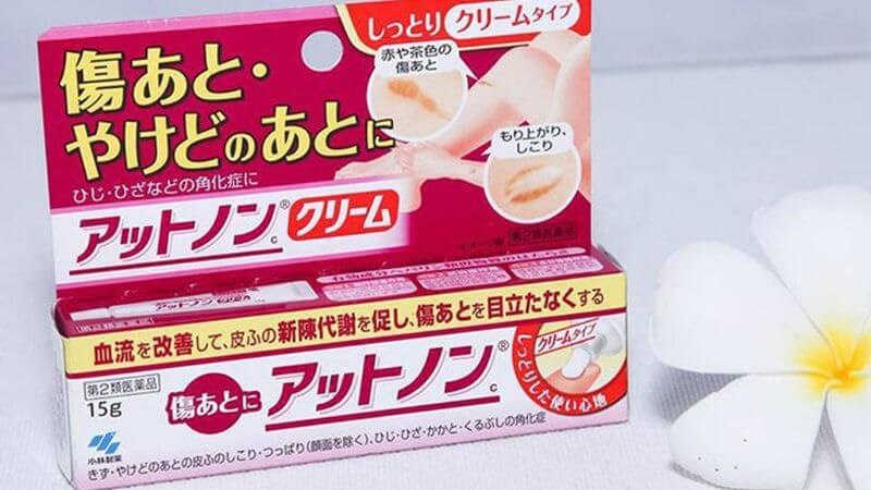 Kem Kobayashi giúp điều trị sẹo lồi lâu năm Kem Kobayashi giúp điều trị sẹo lồi lâu năm