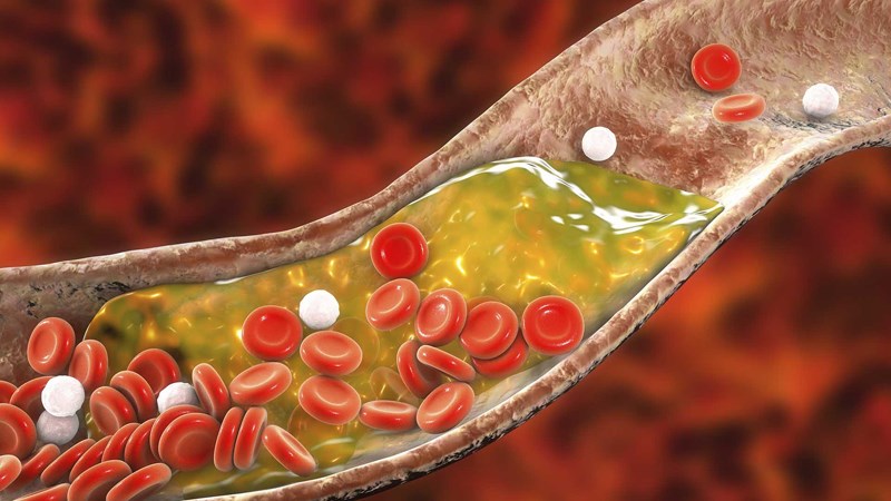 Trà hoa nhài có tác dụng giảm cholesterol trong máu
