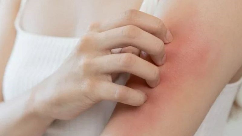 Phấn hoa dâu tằm có thể gây dị ứng