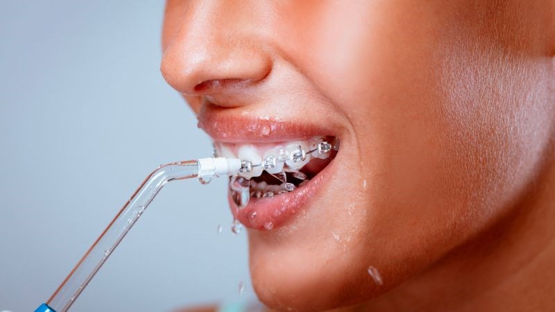 Sử dụng tăm nước giúp làm sạch hiệu quả cho người niềng răng Sử dụng tăm nước giúp làm sạch hiệu quả cho người niềng răng