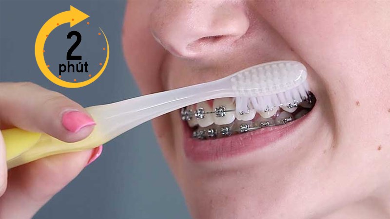 2 phút là thời gian đánh răng tối thiểu giúp làm sạch răng 2 phút là thời gian đánh răng tối thiểu giúp làm sạch răng