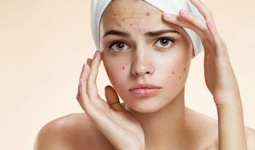 Nội tiết tố thay đổi khi cơ thể dậy thì