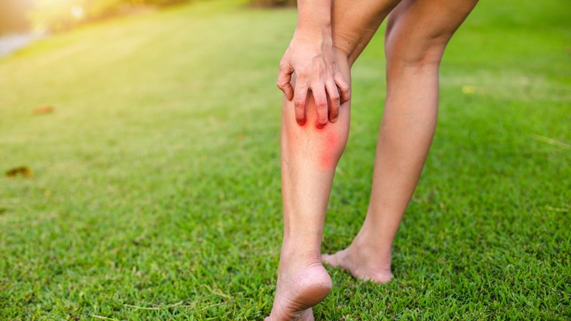 Bắp cải giúp trị mụn nhọt và vết sâu bọ đốt