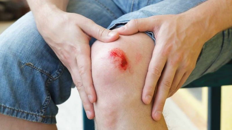 Lysine trong hạt diêm mạch giúp đẩy nhanh quá trình lành vết thương