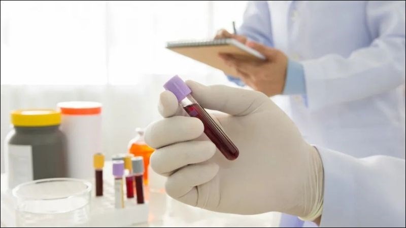 Xét nghiệm định lượng nồng độ CA 125 giúp chỉ điểm ung thư buồng trứng
