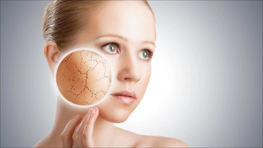Tác dụng phụ của retinol là làm da khô