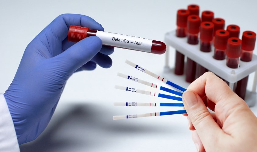 Nồng độ hCG giúp xác định mẹ có mang thai hay không