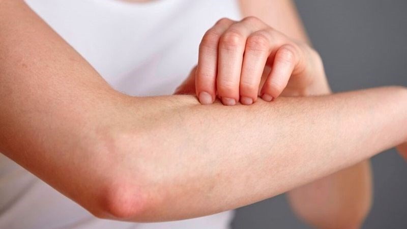 Nước nóng vừa phải giúp làm dịu da bị kích ứng
