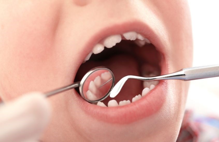 Trẻ em có cấu tạo răng khác biệt so với người lớn