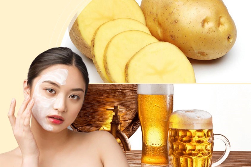 Hướng dẫn cách làm mặt nạ từ bia với khoai tây giúp tẩy sạch tế bào chết hiệu quả