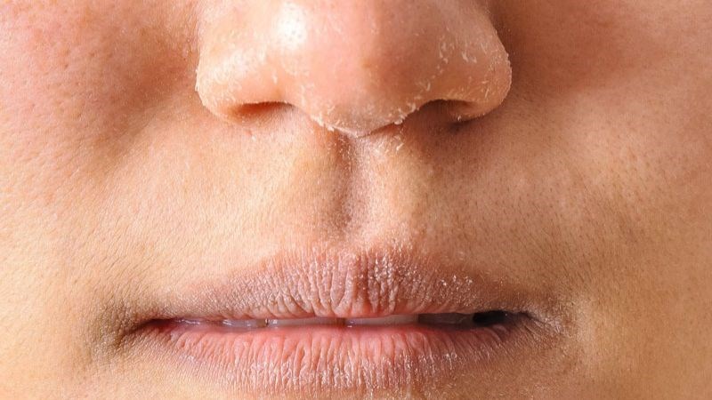 Tắm nước nóng thường xuyên có thể gây khô da