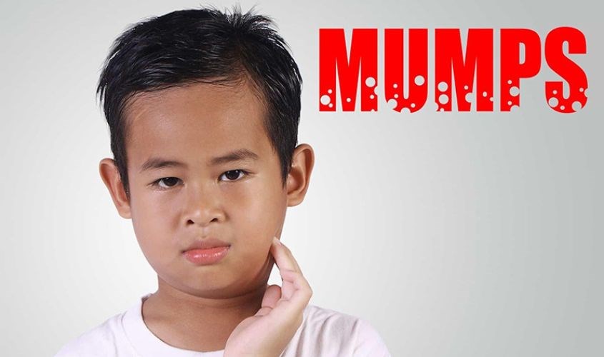 Có nên tiêm phòng quai bị cho trẻ không?