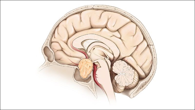 Các khối u tuyến yên tiết ra lượng dư thừa prolactin gây ra trễ kinh