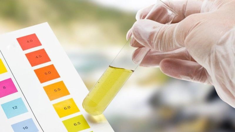 Xét nghiệm nước tiểu để chẩn đoán bệnh