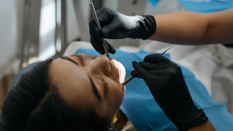 Các tình trạng răng miệng khác