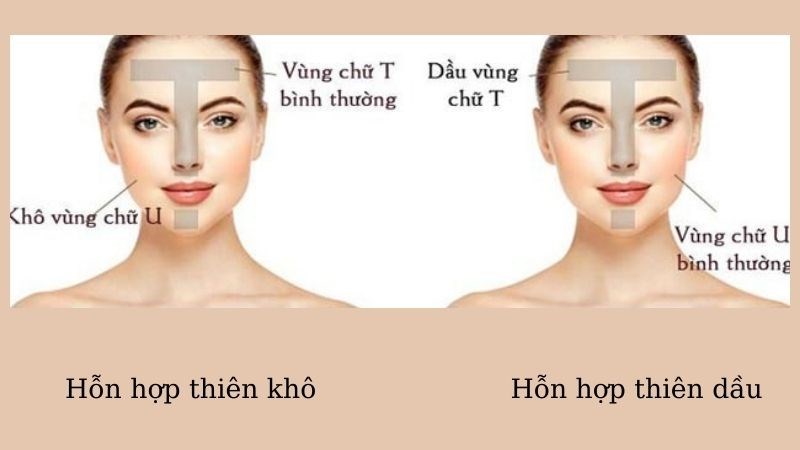 Da hỗn hợp Da hỗn hợp