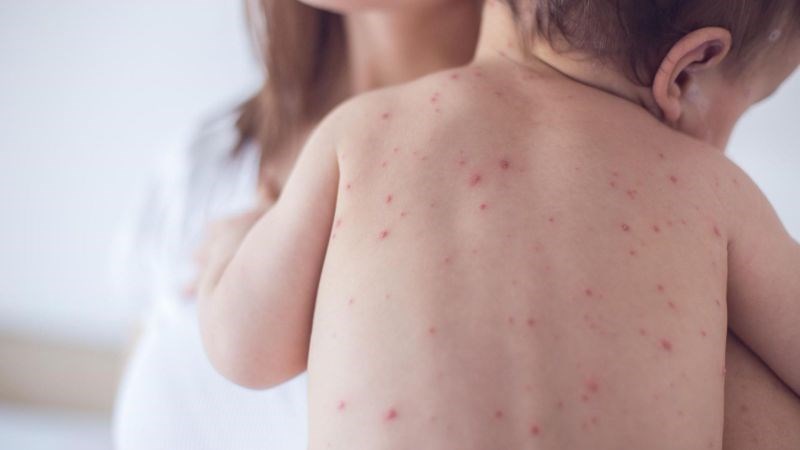 Giai đoạn khởi phát triệu chứng không điển hình