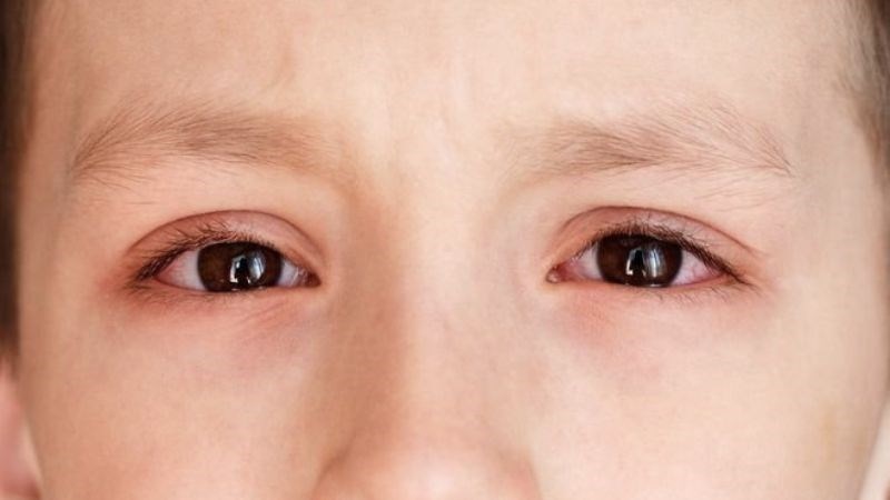 Nhỏ sữa mẹ vào mắt bé có thể gây viêm nội nhãn Nhỏ sữa mẹ vào mắt bé có thể gây viêm nội nhãn