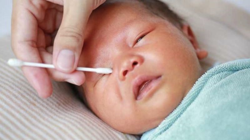 Dùng tăm bông thấm khô nước đọng ở mắt bé sau khi đã vệ sinh Dùng tăm bông thấm khô nước đọng ở mắt bé sau khi đã vệ sinh