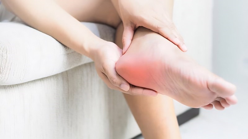 Viêm cân gan chân là nguyên nhân hàng đầu gây ra đau gót chân