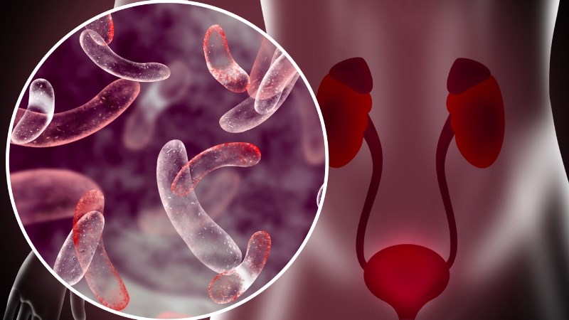 Nhiễm trùng đường tiết niệu làm tăng nhu cầu đi tiểu hơn bình thường do đường niệu bị kích thích bởi viêm nhiễm Nhiễm trùng đường tiết niệu