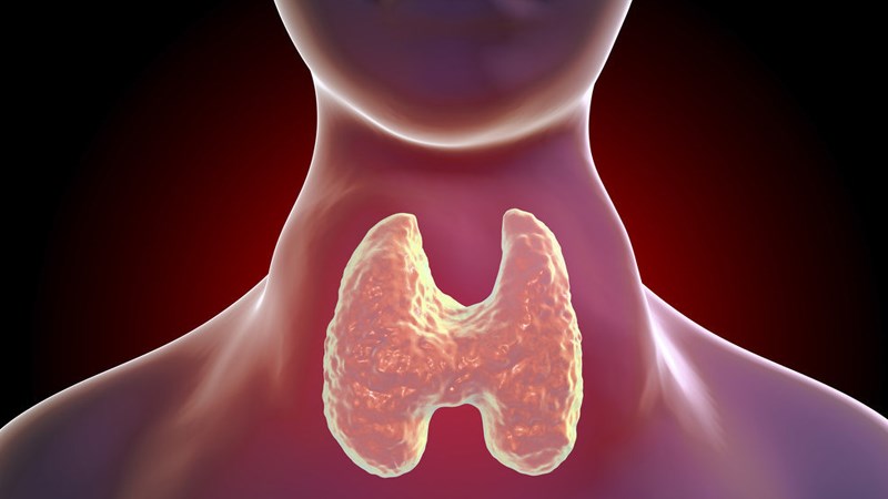 Bướu cổ ác tính còn được gọi là ung thư tuyến giáp