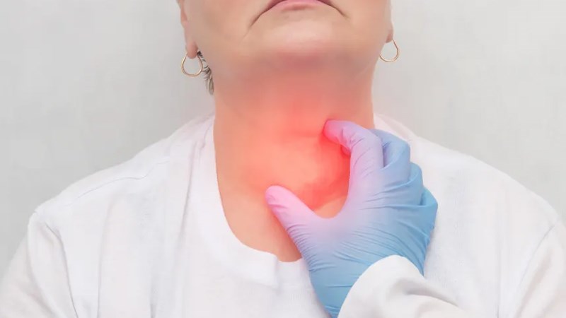 Hashimoto là một bệnh tự miễn gây ra bướu cổ