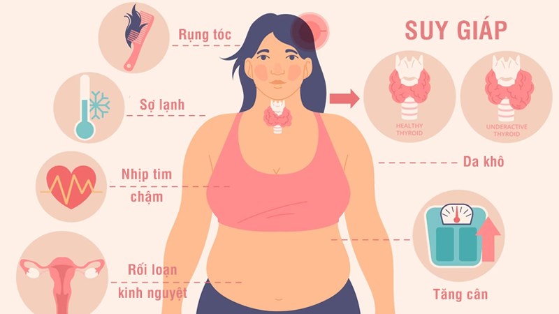 Các triệu chứng hay gặp của bệnh suy giáp