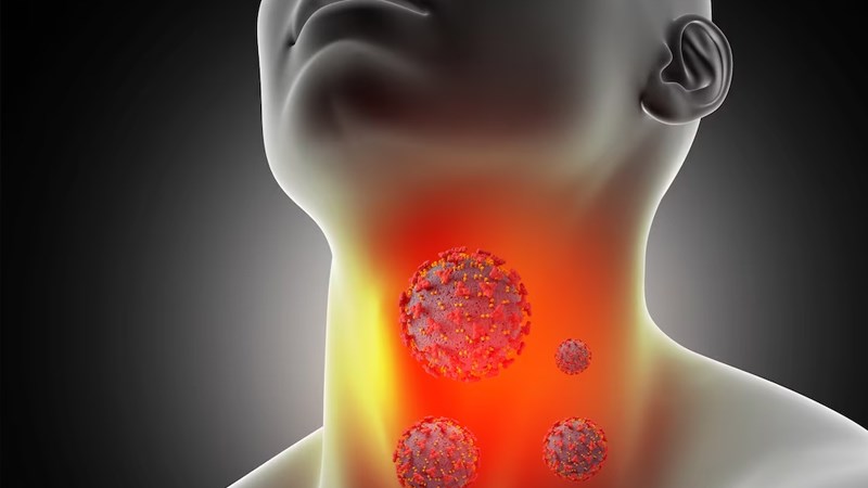 Viêm tuyến giáp có thể gây ra bướu cổ