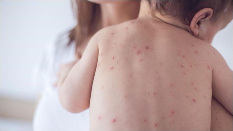 Dấu hiệu cần gặp bác sĩ Dấu hiệu cần gặp bác sĩ