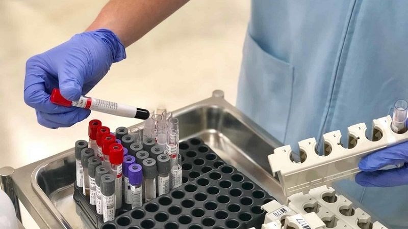 Xét nghiệm chẩn đoán Xét nghiệm chẩn đoán