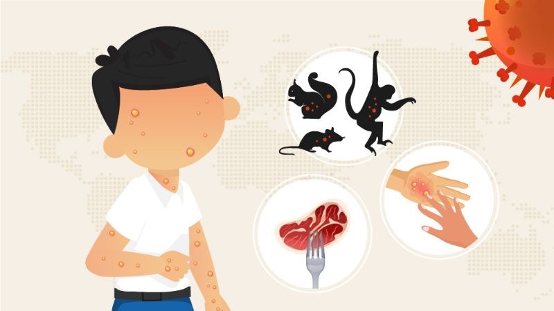Con đường lây lan của đậu mùa khỉ và thủy đậu Con đường lây lan của đậu mùa khỉ và thủy đậu