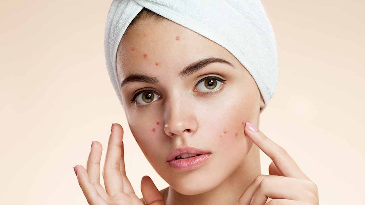 Bạn có thể ngăn ngừa mụn tốt với máy rửa mặt Bibury