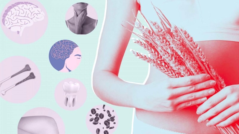 Celiac biểu hiện nhiều triệu chứng