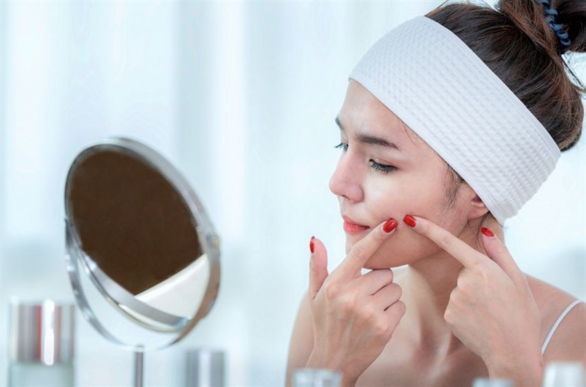 Cách chăm sóc da mặt bị mụn đầu đen đúng cách 