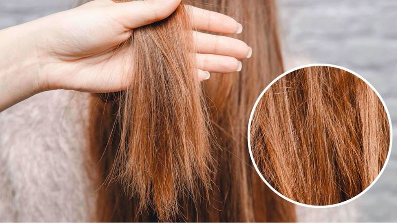Bệnh tuyến giáp gây tóc, móng, da của bạn bị suy yếu