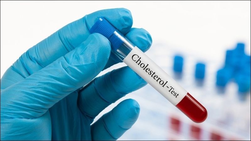 Ăn hành tây giúp giảm mức cholesterol