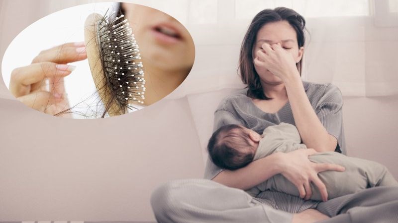 9 cách giảm rụng tóc sau sinh an toàn và hiệu quả cho mẹ bỉm