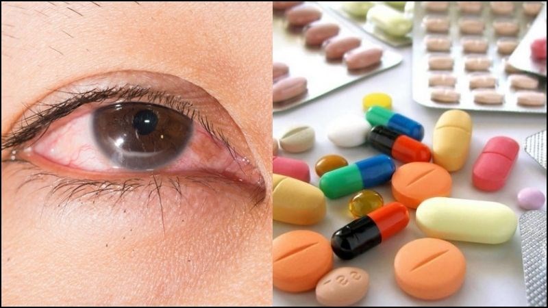 Dị ứng thuốc c&oacute; thể khiến bạn bị ngứa kh&oacute;e mắt