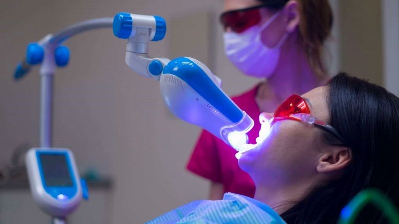 Tẩy trắng răng an toàn khi được thực hiện bởi người có chuyên môn