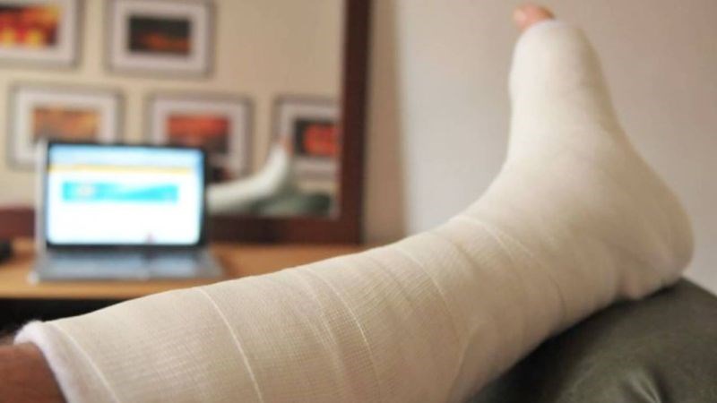 Kỹ thuật vật lý trị liệu nào được sử dụng phổ biến để trị liệu cho người gãy chân?
