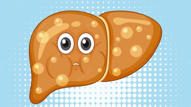 Gan nhiễm mỡ là một trong những nguyên nhân phổ biến dẫn đến viêm gan hiện nay